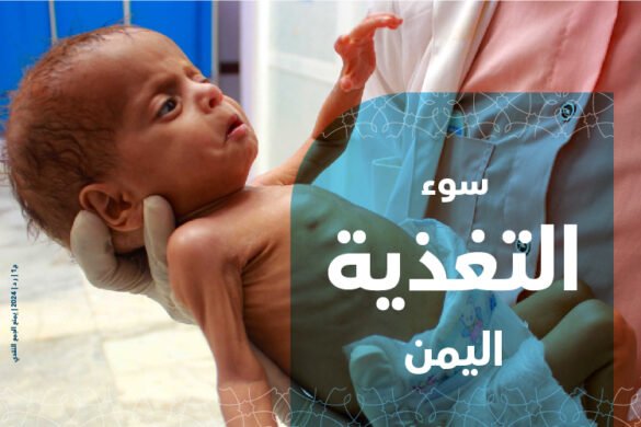 أطفال اليمن يعانون من سؤ التغذية