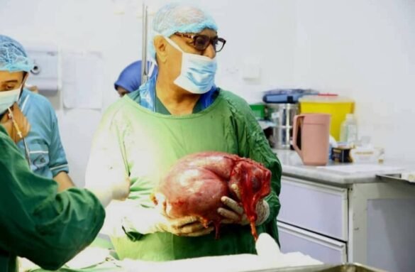 عملية جراحية بمستشفى سيبلاس