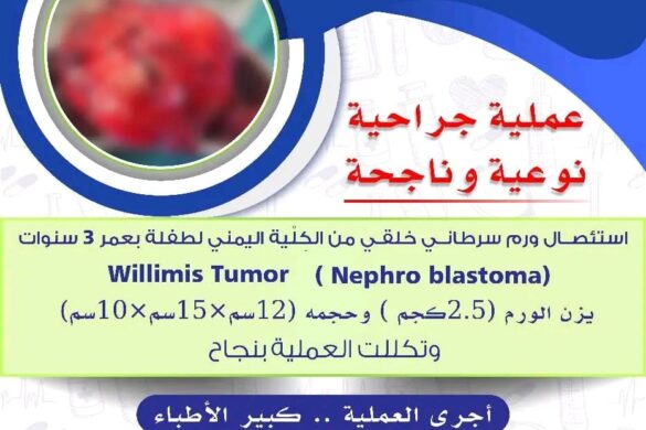 استئصال ورم سرطان من كلية طفلة بالمستشفى الاهلي الحديث