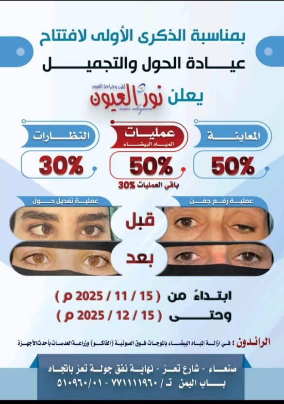 مركزنورالعيون يعلن عن باقة تخفيضات بمناسبة الذكرى الأولى لافتتاح عيادة الحول والتجميل