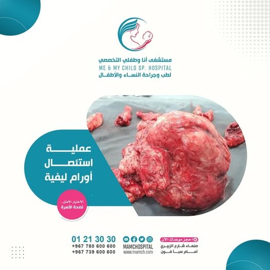 نجاح عملية استئصال أورام ليفية مع الحفاظ على الخصوبة في مستشفى أنا وطفلي التخصصي