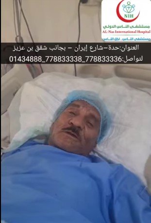 مستشفى الناس الدولي يحقق إنجازًا طبيًا بإنقاذ مريض من جلطة دماغية