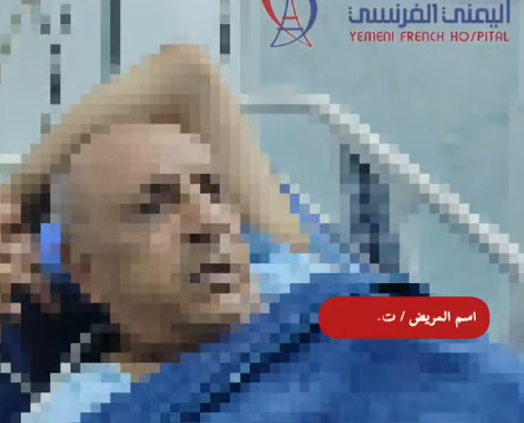 المستشفى اليمني الفرنسي يحقق نجاحًا جديدًا في علاج انسداد الشرايين ضمن مبادرة "رحلة شفاء"